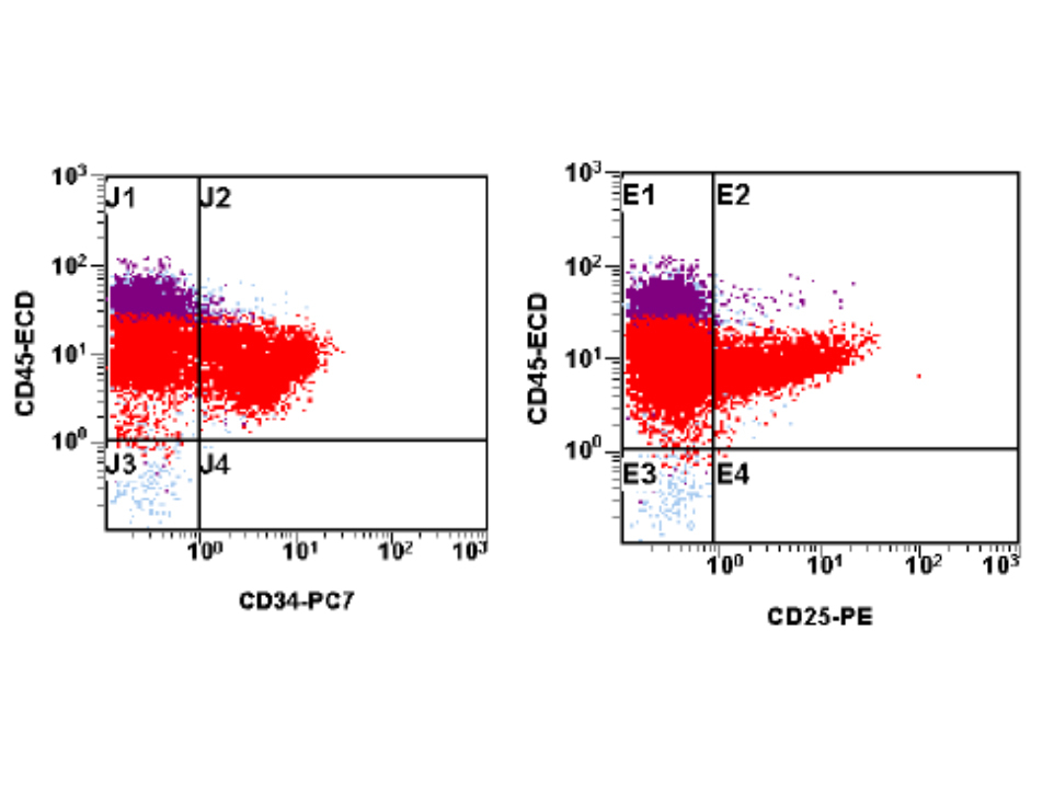 Figure 4. 2-12-10 Bone Marrow, Flow Cytometry